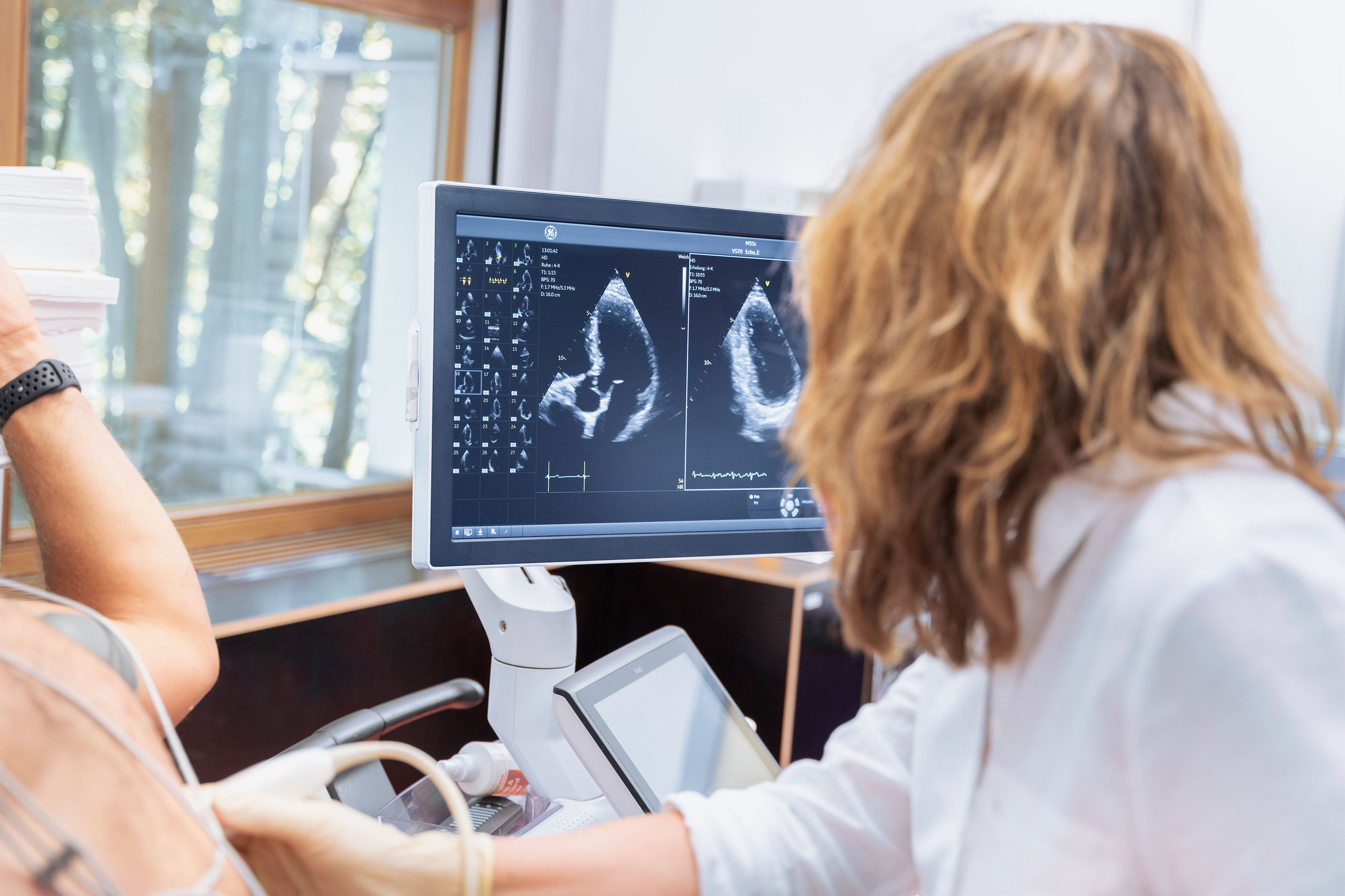 Echokardiographie Herzklinik Ulm