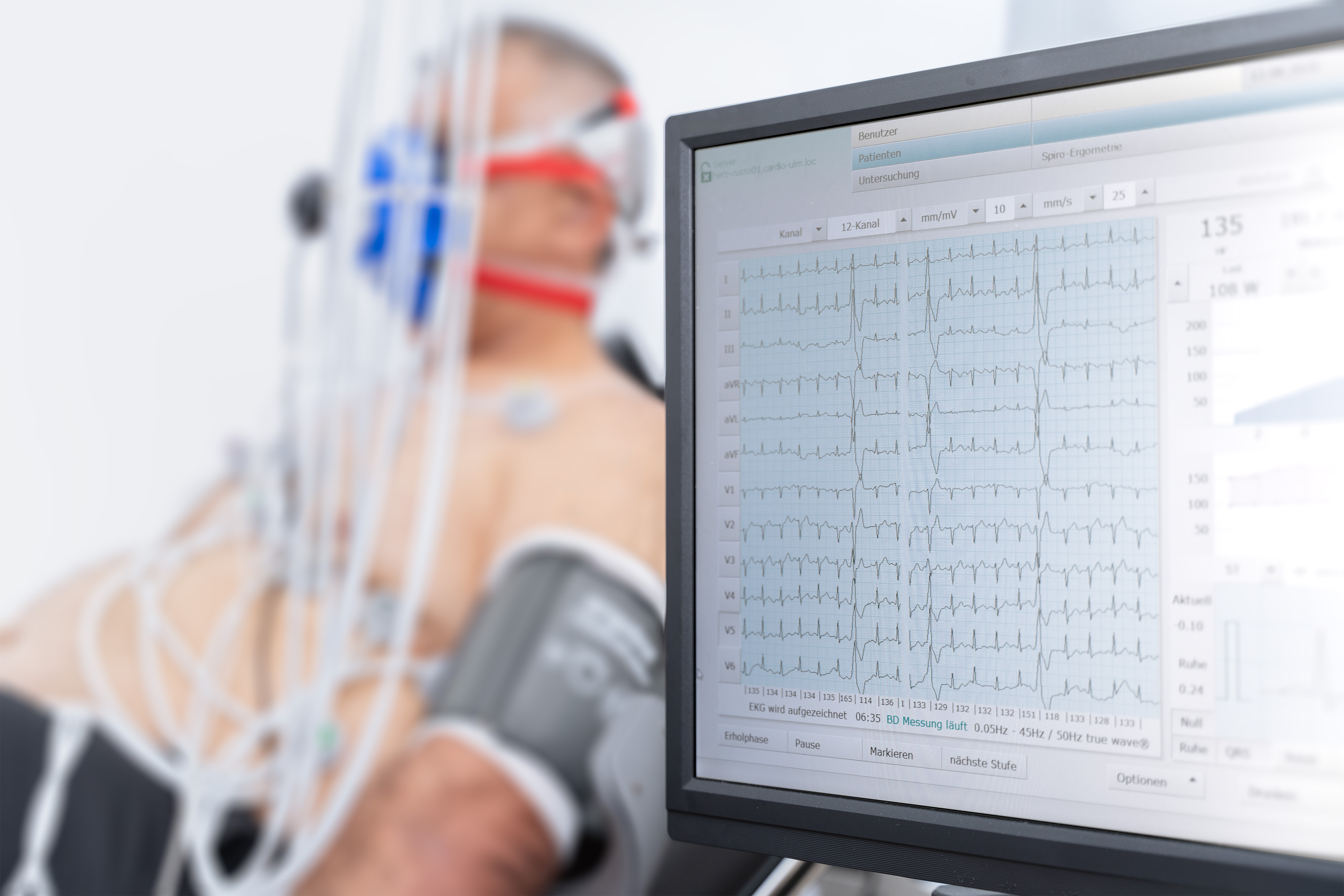 Spiroergometrie_Abbildung der Herzfunktion_Cardiologicum Herzklinik Ulm