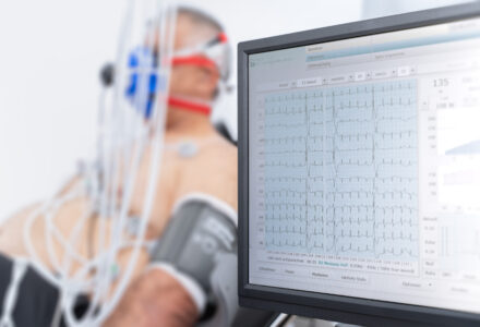 Spiroergometrie_Abbildung der Herzfunktion_Cardiologicum Herzklinik Ulm